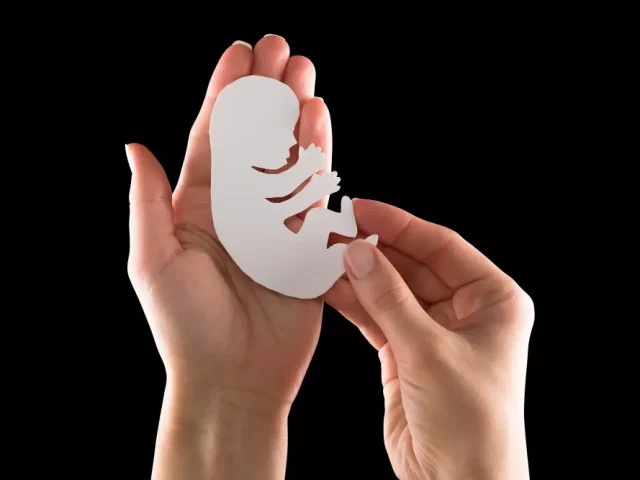 IVF Step‑by‑Step