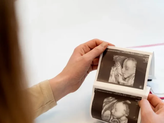 The Science of Implantation – How to Improve Your Odds