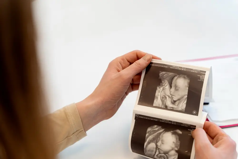 embryo implantation