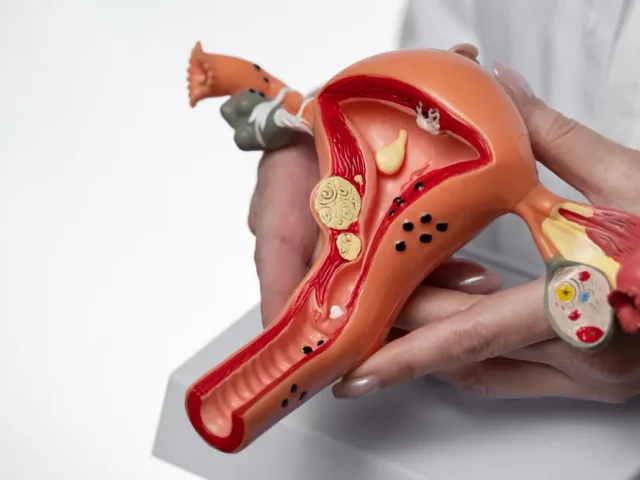 8 Unknown Facts: What Happens to Eggs After a Hysterectomy