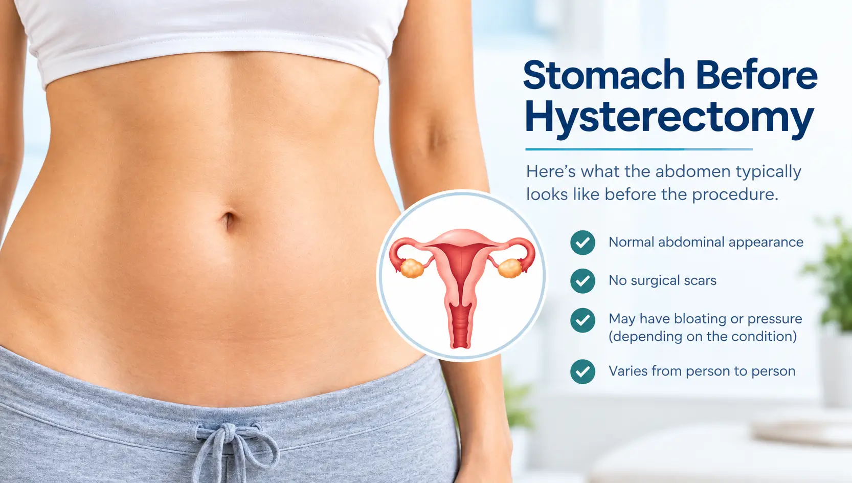 Pictures of Stomach Before Hysterectomy